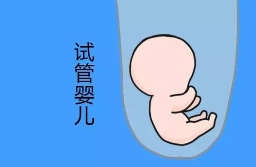 液氮存储